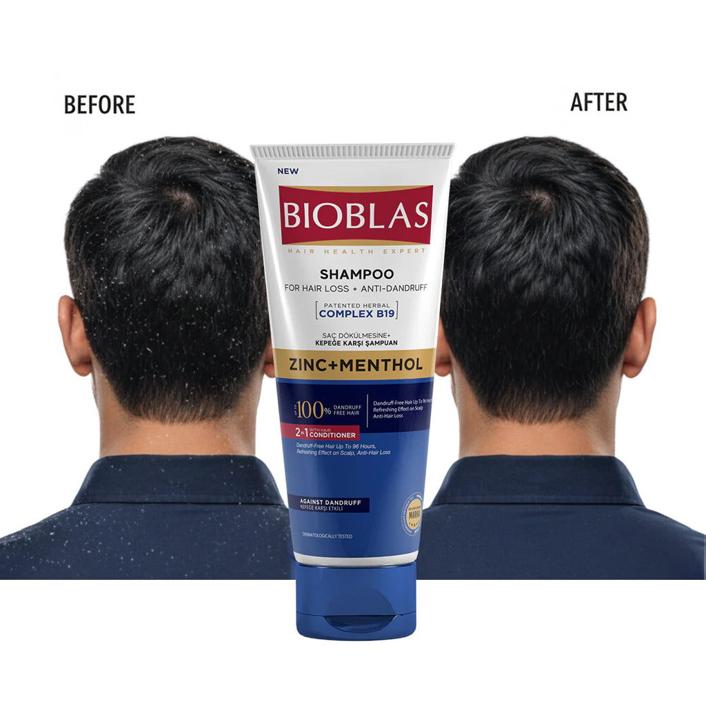 Bioblas Anti-Hair Loss, Anti-Dandruff and Anti-Itching Shampoo And Conditioner 250 Ml Offer (1+50%)