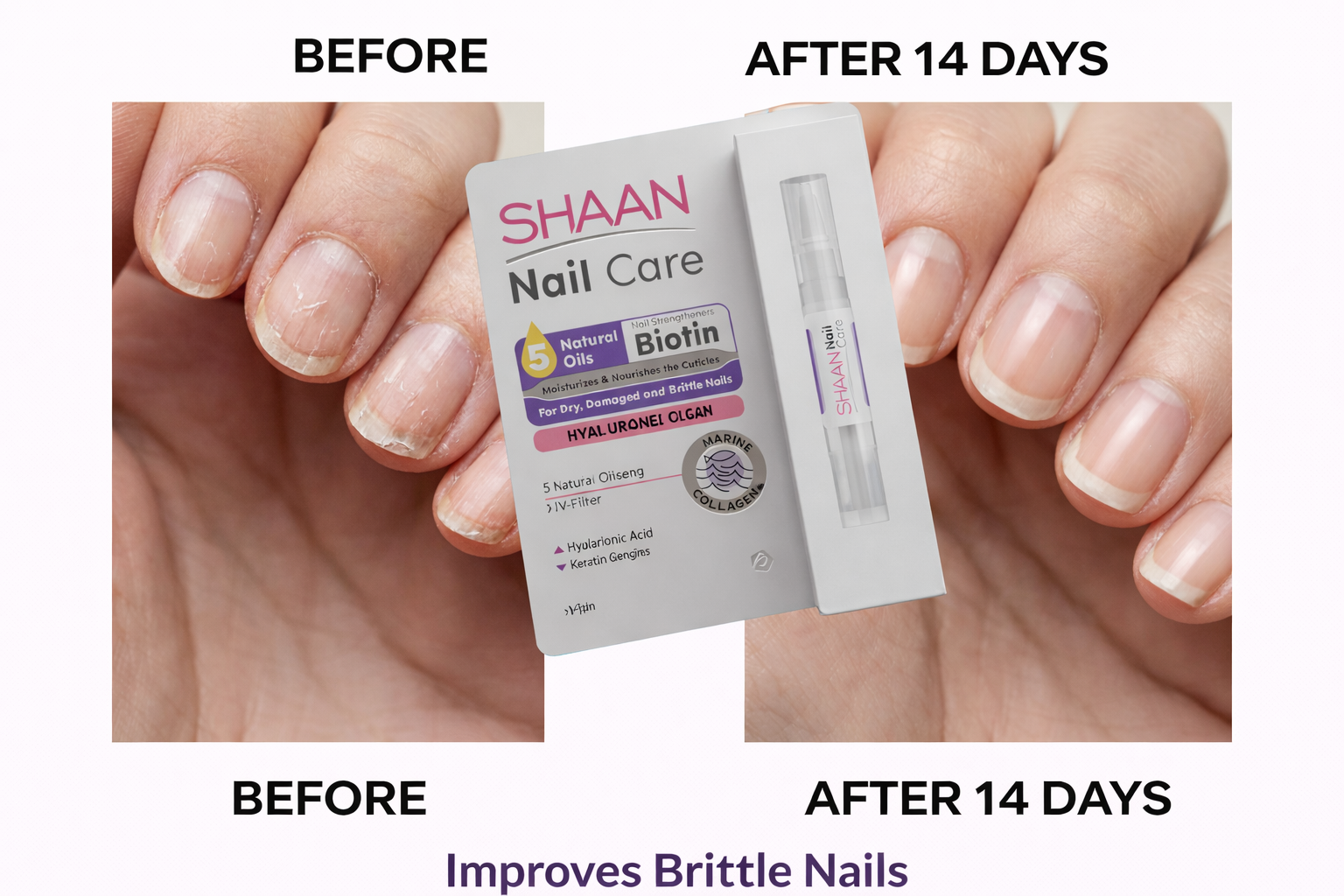 Shaan Nail Care 4 ml - E Parkville