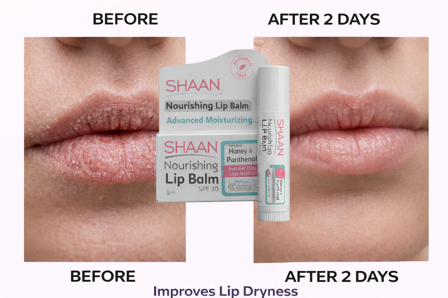 Shaan Lip Balm SPF 30 5 gm - E Parkville