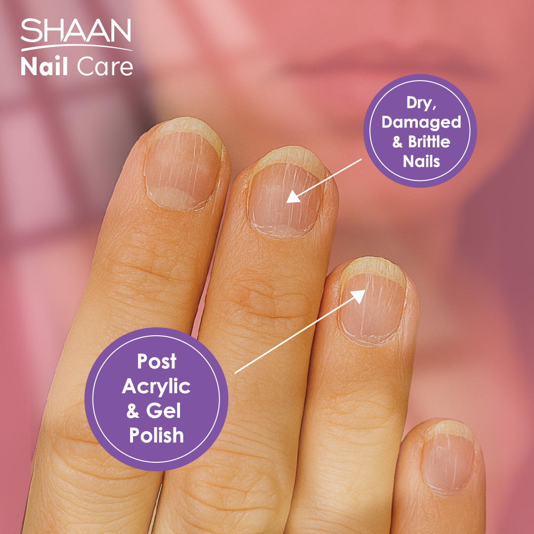 Shaan Nail Care 4 ml - E Parkville